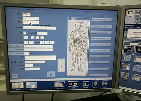 天地智慧醫(yī)療射線系統(tǒng)界面設(shè)計(jì)
界面設(shè)計(jì) | 交互設(shè)計(jì)