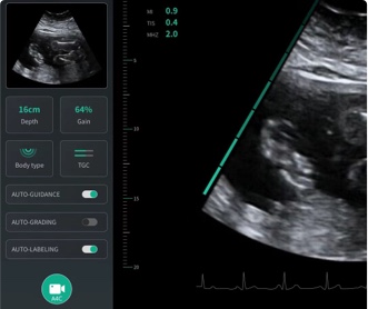 某人工智能研究所醫(yī)療影像軟件UI設計（保密）