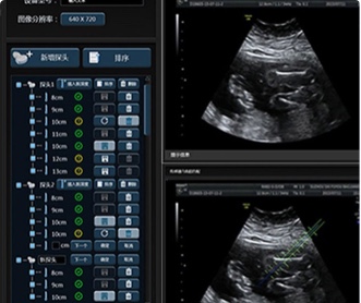 武漢睿影醫(yī)療科技超聲系統(tǒng)軟件UI設計